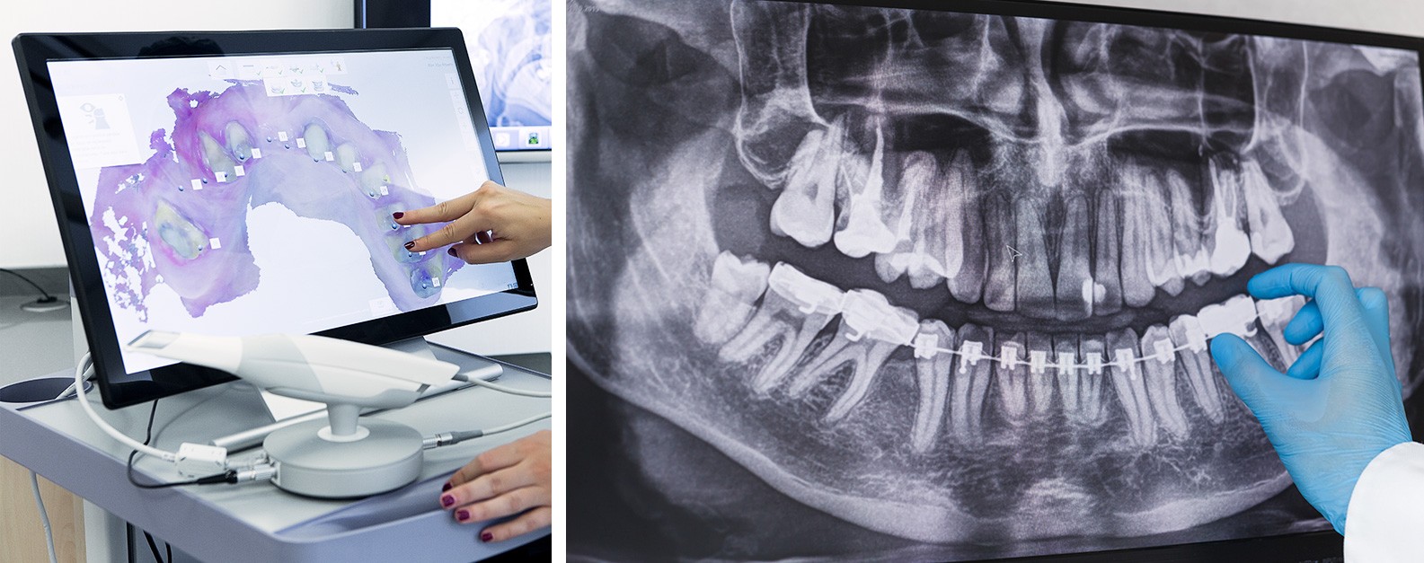 radiografia digital odontología