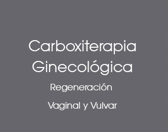 carboxiterapia ginecológica Dermonova