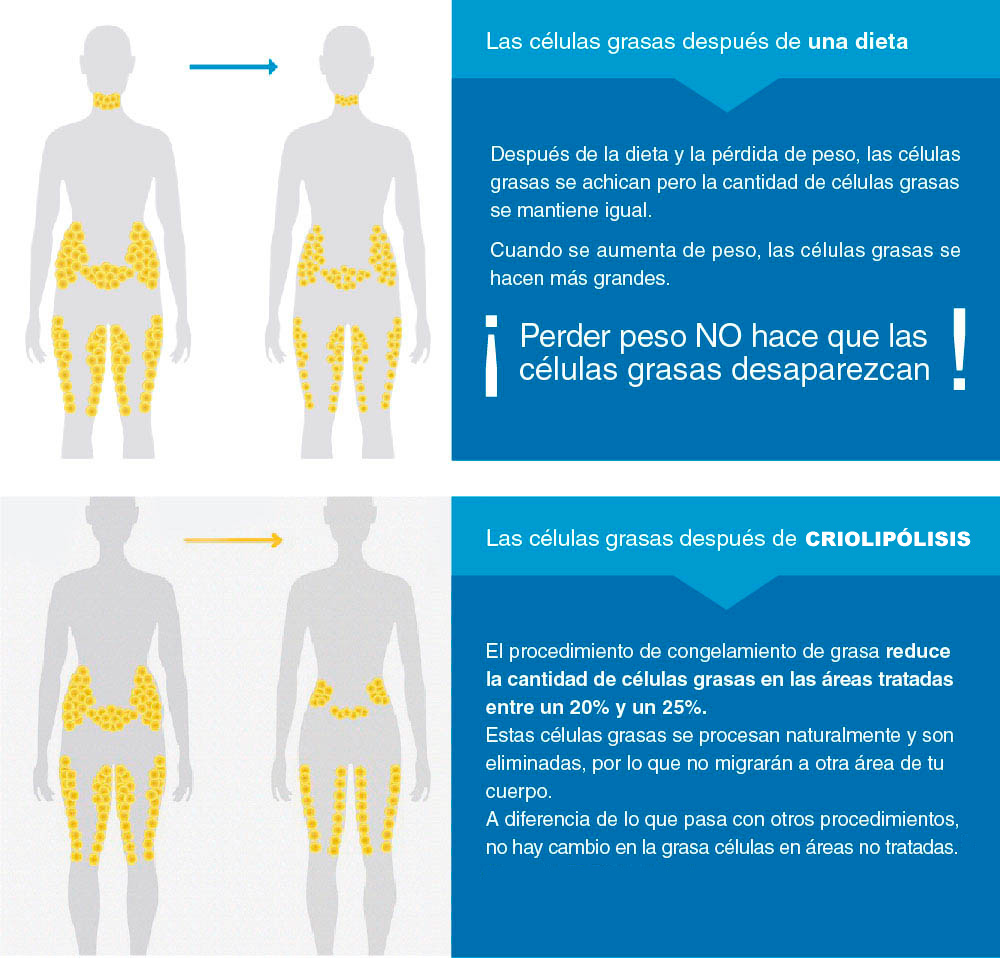 grasa localizada Málaga