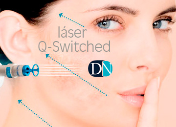 Láser Q-Switched: antiaging, cicatrices, lesiones y manchas, tatuajes, onicomicosis