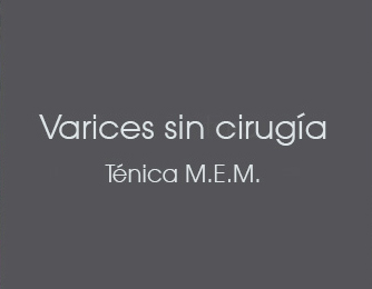 Varices sin cirugía