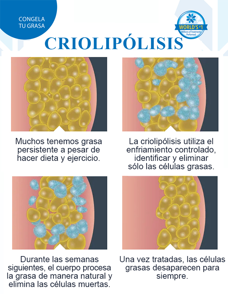 grasa localizada