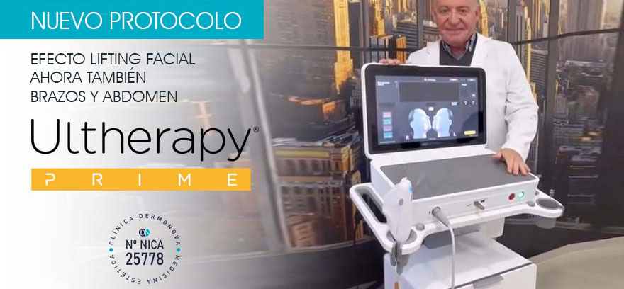 Ultherapy Prime Málaga