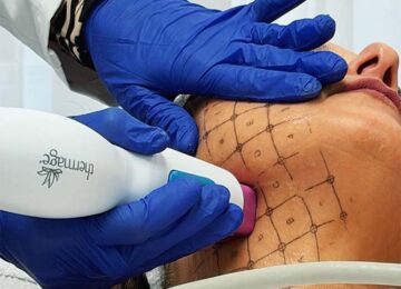 Reaffirmage: radiofrecuencia para flacidez y contornos