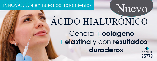tratamiento ácido hialurónico Málaga