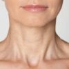 cuello, óvalo facial y papada