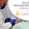 rellenos hidrpxiapatita de calcio más Ultherapy