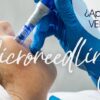 mejor microneedling Málaga