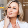 Ultherapy Prime y Reaffirmage en Dermonova Málaga